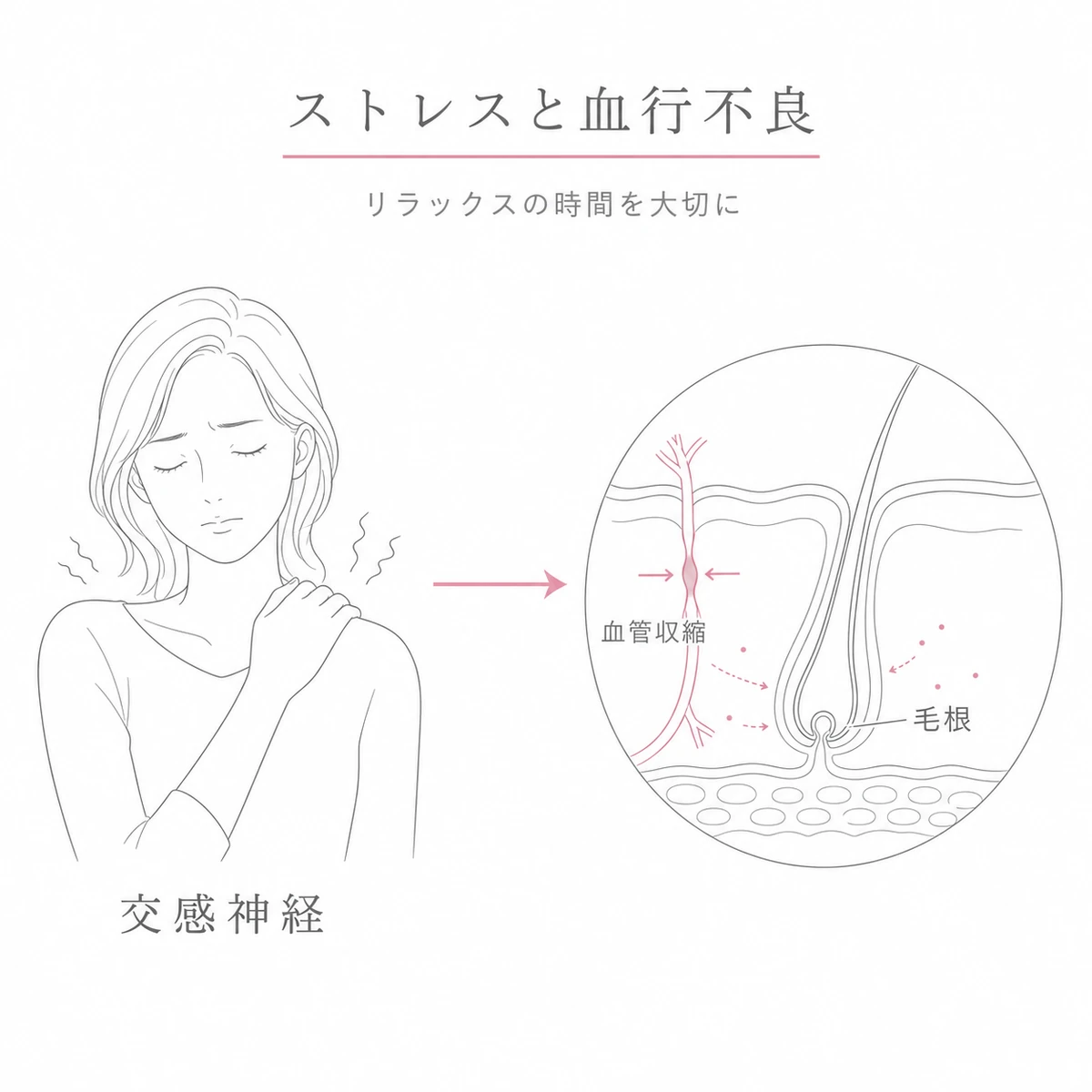 ストレスによる交感神経の緊張が頭皮の血管を収縮させ毛根の栄養を妨げる流れを表した線画イラスト