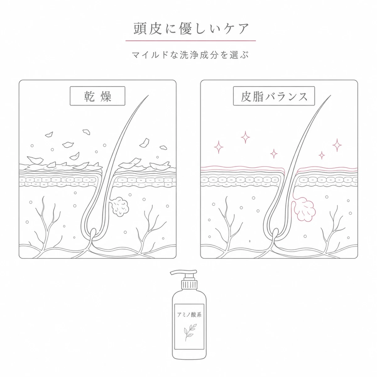 強い洗浄で乾燥した頭皮とマイルドな洗浄で健やかな頭皮を対比した線画イラスト