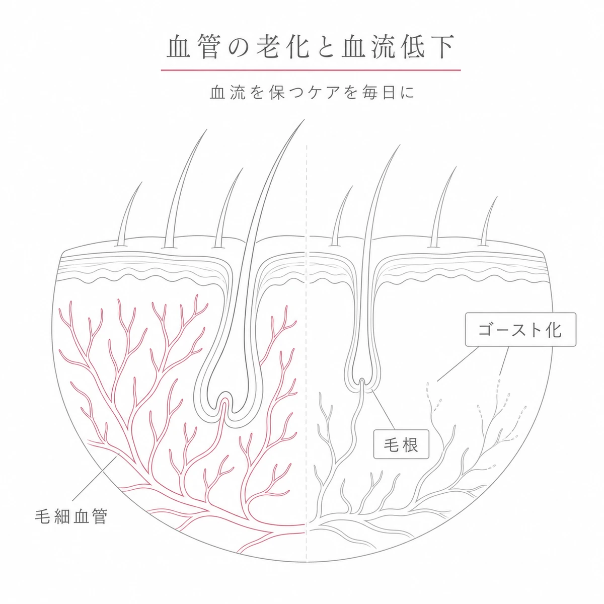 加齢で頭皮の毛細血管がゴースト化し毛根の栄養が減る変化を対比した線画イラスト