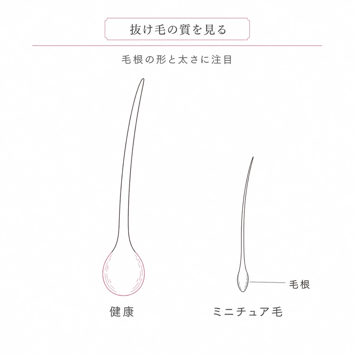 健康な抜け毛と成長途中で抜けた細いミニチュア毛の毛根の形を左右で比べた線画イラスト