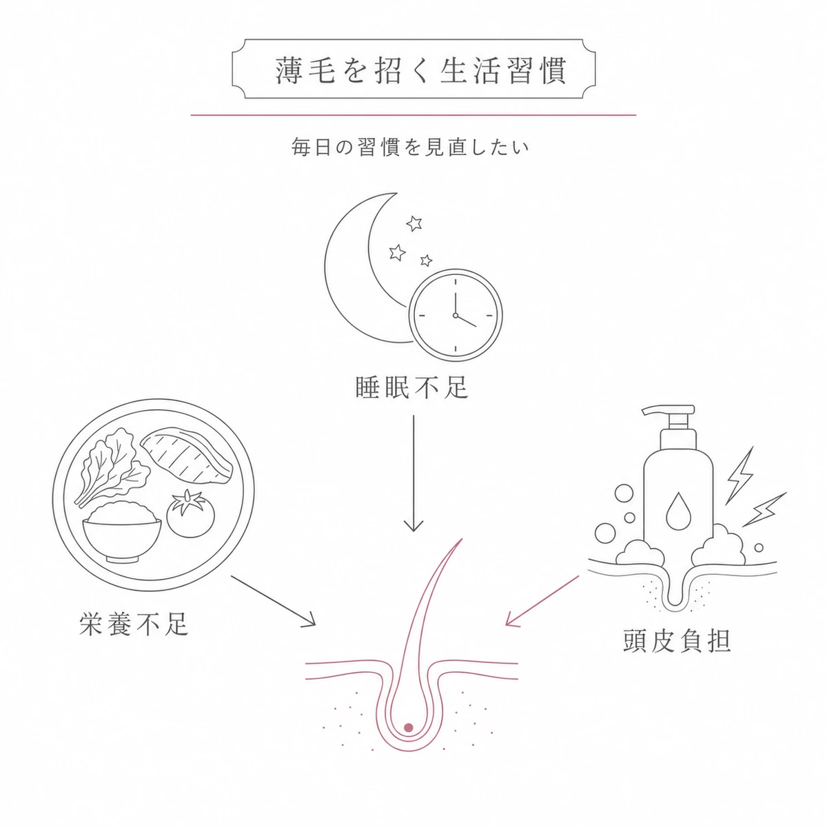 栄養不足・睡眠不足・頭皮への負担が薄毛を悪化させる生活習慣を相関図で表した線画イラスト