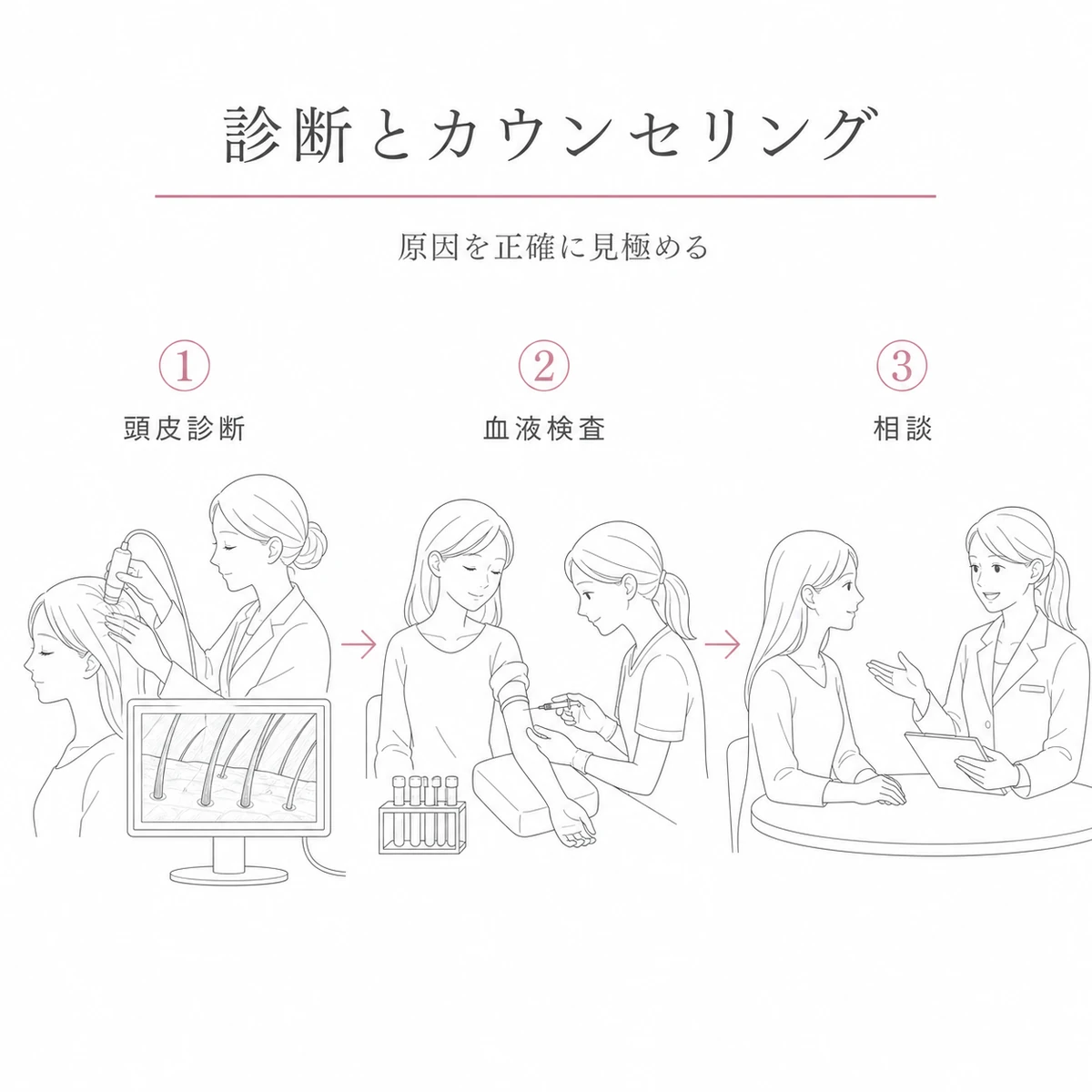 頭皮診断から血液検査とカウンセリングへ進む専門クリニックでの受診の流れを表した線画イラスト