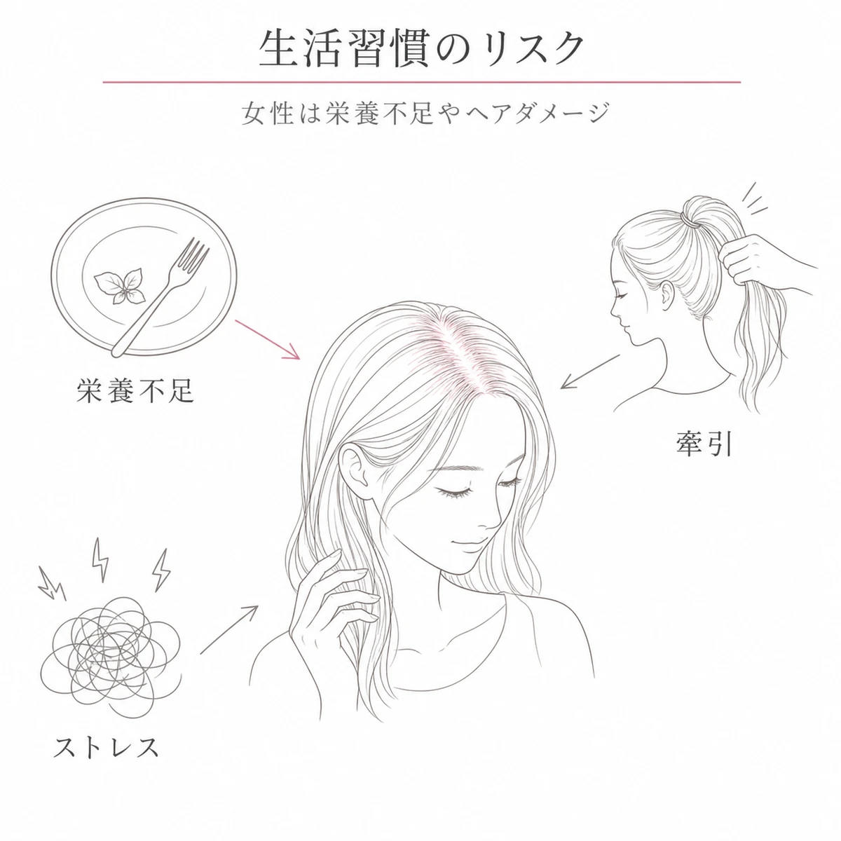 女性に多い栄養不足や牽引ストレスが髪へ影響する生活習慣リスクを相関図で表した線画イラスト