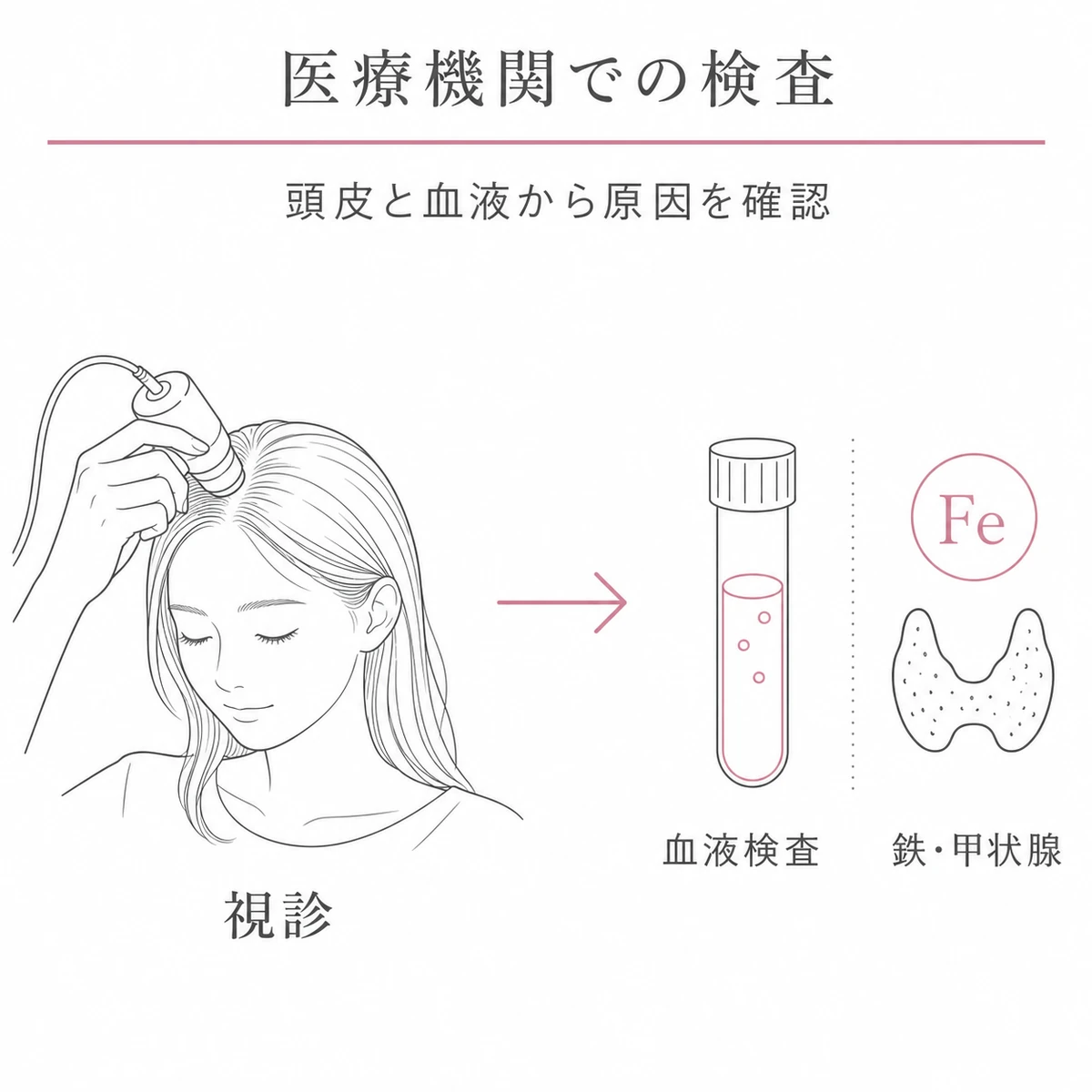 頭皮の視診から血液検査へと進み薄毛の原因を確認する診断の流れを表した線画イラスト