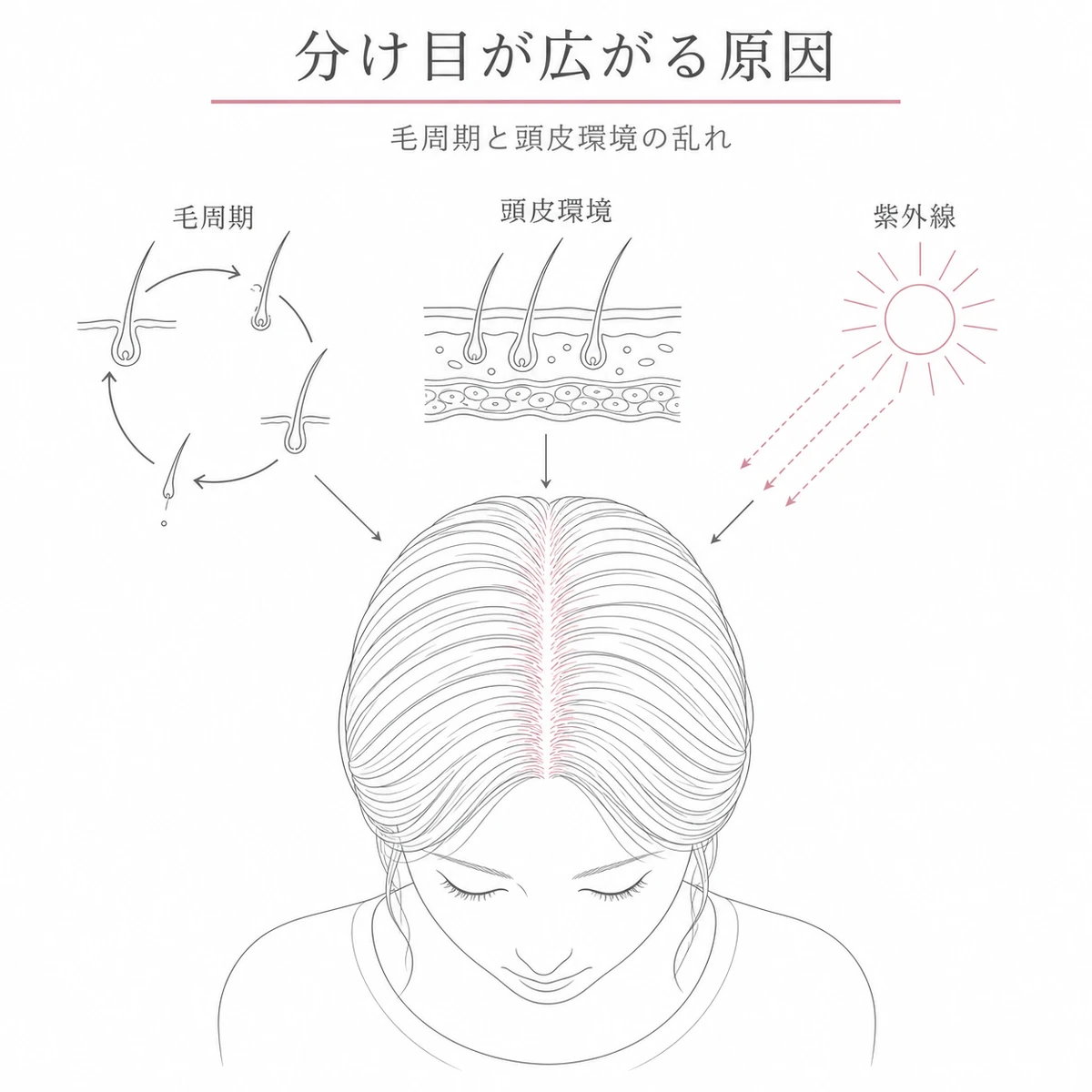 毛周期の乱れと頭皮環境の悪化や紫外線が分け目の広がりを招く関係を表した線画イラスト