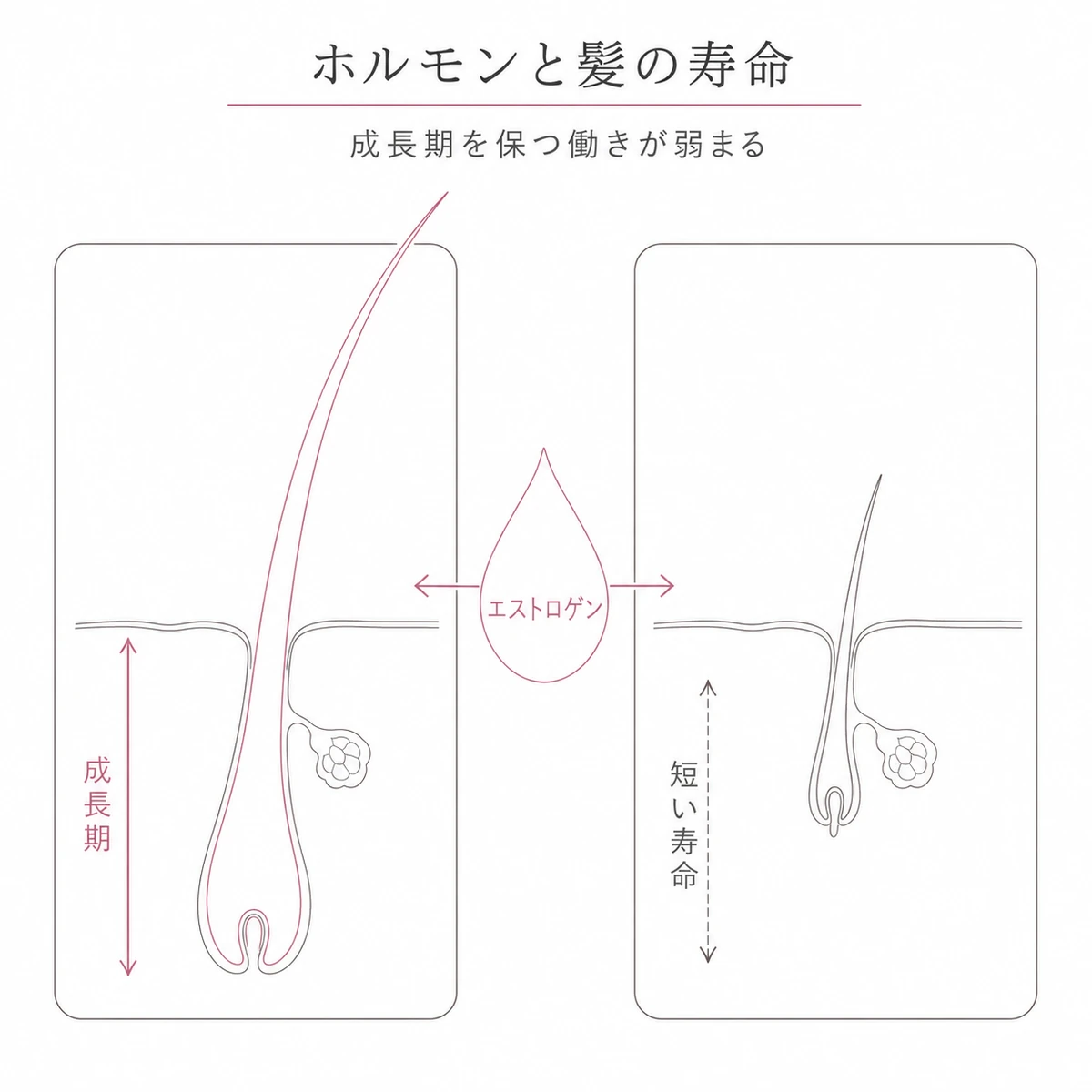 エストロゲンの減少で髪の成長期が短くなり細く抜けやすくなる変化を対比した線画イラスト