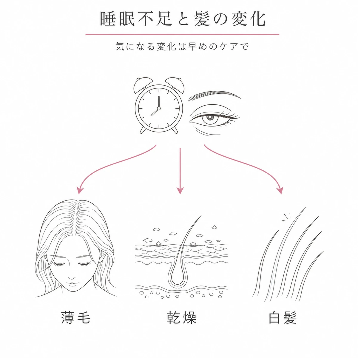 睡眠不足が薄毛・頭皮の乾燥・白髪の3つのトラブルに分かれる様子を表した線画イラスト