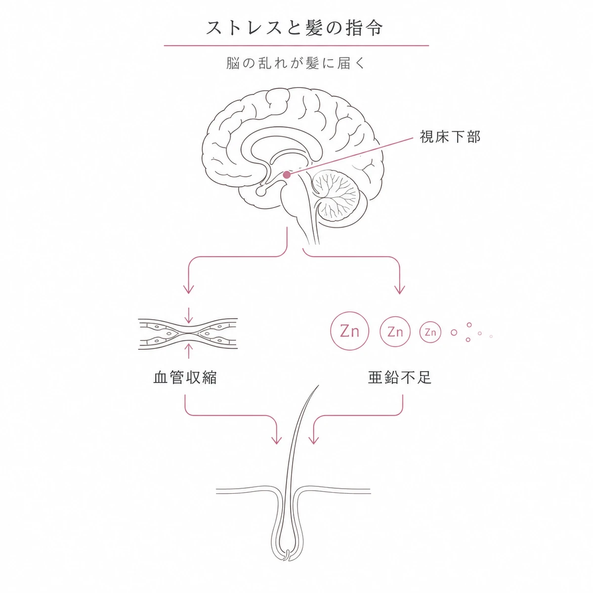ストレスが脳の指令を乱し血管収縮と亜鉛不足で毛根の栄養を奪う流れを表した線画イラスト