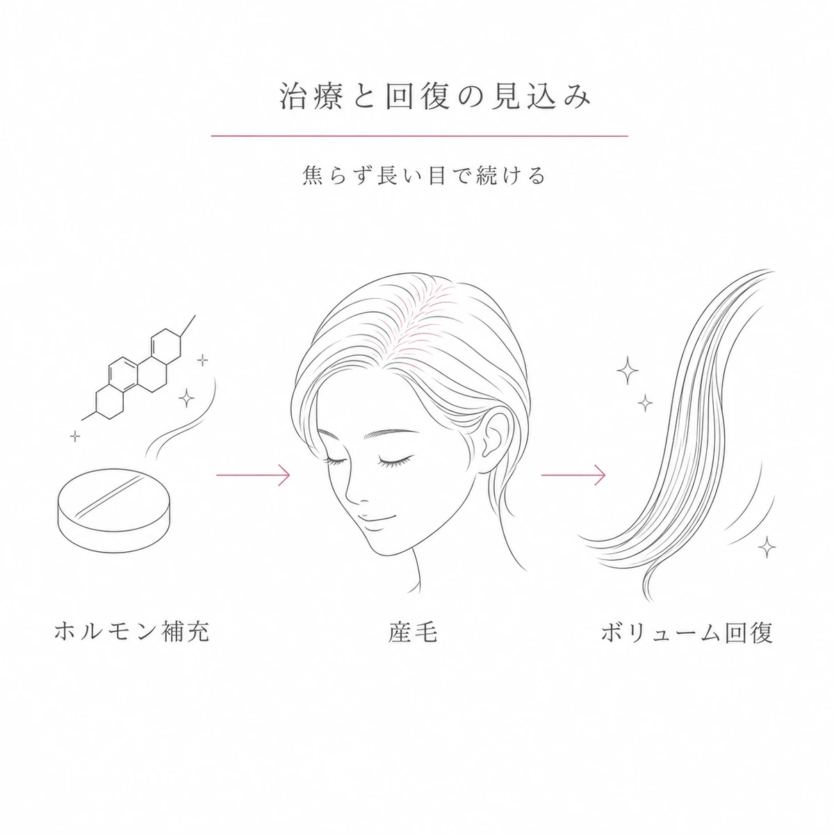 ホルモン補充から産毛が生えボリュームが戻る治療と回復の流れを表した線画イラスト