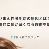 びまん性脱毛症の原因とは？全体的に髪が薄くなる理由を知る