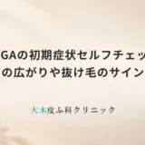 FAGAの初期症状セルフチェック｜分け目の広がりや抜け毛のサインを確認