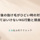 産後の抜け毛がひどい時の対策｜やってはいけないNG行動と頭皮ケア