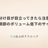 分け目が目立ってきたら注意｜頭頂部のボリューム低下のサイン