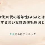 20代30代の若年性FAGAとは？急増する若い女性の薄毛原因と特徴