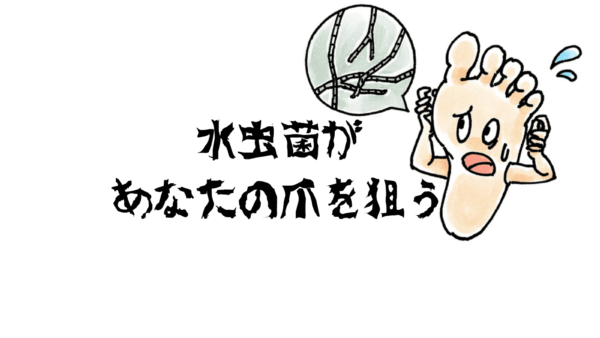 爪水虫であなたも周りも足がぼろぼろに！白癬菌（はくせんきん）を知って、みんなの足を守ろう