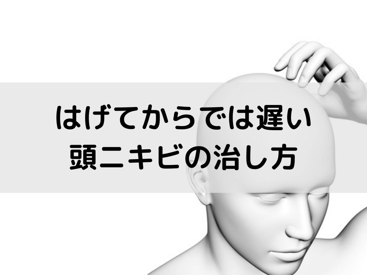 頭ニキビの治し方｜痛くても、潰してはげる前に試すべき治療方法