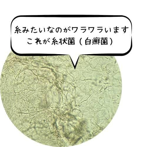 糸状菌　白癬菌