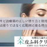 ニキビ治療薬の正しい塗り方と使用量｜点塗りではなく広範囲に塗る理由