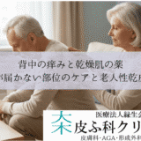 背中の痒みと乾燥肌の薬｜手が届かない部位のケアと老人性乾皮症