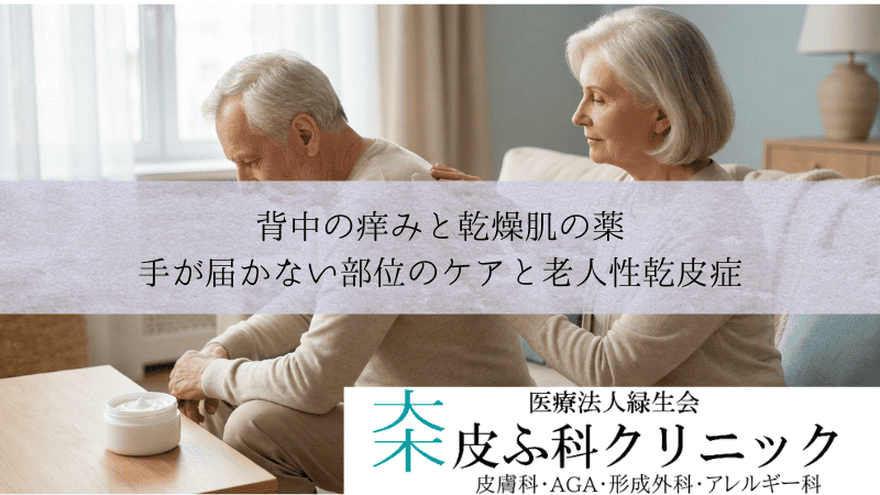 背中の痒みと乾燥肌の薬｜手が届かない部位のケアと老人性乾皮症