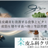 脂漏性皮膚炎を改善する食事とビタミンB群｜皮脂を増やす食べ物と生活習慣