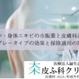 背中・身体ニキビの市販薬と皮膚科治療｜スプレータイプの効果と保険適用の限界