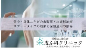 背中・身体ニキビの市販薬と皮膚科治療|スプレータイプの効果と保険適用の限界