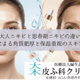 大人ニキビと思春期ニキビの違い｜乾燥による角質肥厚と保湿重視のスキンケア