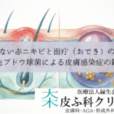 治らない赤ニキビと面疔（おでき）の違い｜黄色ブドウ球菌による皮膚感染症の鑑別