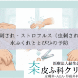 子供の虫刺され・ストロフルス（虫刺され過敏症）｜水ぶくれととびひの予防