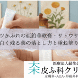 オムツかぶれの亜鉛華軟膏・サトウザルベ｜白く残る薬の落とし方と重ね塗り