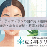 ベピオ・ディフェリンの副作用（随伴症状）｜赤み・皮むけが続く期間と対処法