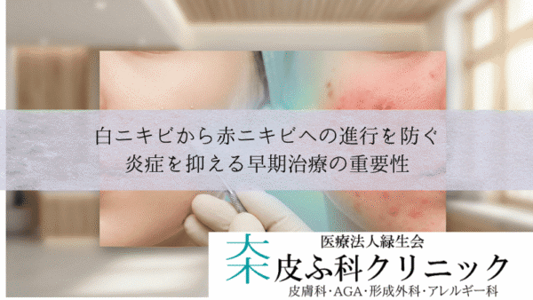 白ニキビから赤ニキビへの進行を防ぐ｜炎症を抑える早期治療の重要性