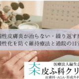 脂漏性皮膚炎が治らない・繰り返す原因｜慢性化を防ぐ維持療法と通院の目安