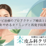 ニキビ治療のプロアクティブ療法とは？｜薬をやめるタイミングと再発予防期間