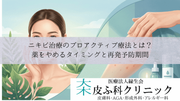 ニキビ治療のプロアクティブ療法とは？｜薬をやめるタイミングと再発予防期間