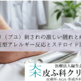 ブヨ（ブユ）刺されの激しい腫れと痛み｜遅延型アレルギー反応とステロイド治療