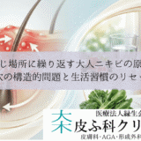 同じ場所に繰り返す大人ニキビの原因｜毛穴の構造的問題と生活習慣のリセット