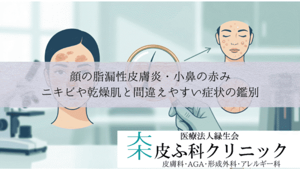 顔の脂漏性皮膚炎・小鼻の赤み｜ニキビや乾燥肌と間違えやすい症状の鑑別