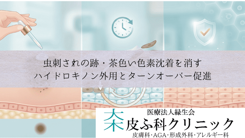 虫刺されの跡・茶色い色素沈着を消す|ハイドロキノン外用とターンオーバー促進