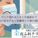 マスク荒れはニキビか湿疹か？｜症状の見分け方と皮膚科での薬の選び方