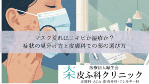 マスク荒れはニキビか湿疹か?|症状の見分け方と皮膚科での薬の選び方