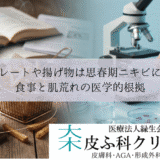 チョコレートや揚げ物は思春期ニキビに悪い？食事と肌荒れの医学的根拠