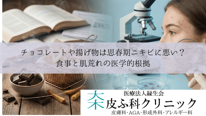 チョコレートや揚げ物は思春期ニキビに悪い？食事と肌荒れの医学的根拠
