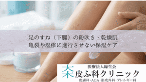 足のすね（下腿）の粉吹き・乾燥肌｜亀裂や湿疹に進行させない保湿ケア