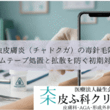 毛虫皮膚炎（チャドクガ）の毒針毛除去｜ガムテープ処置と拡散を防ぐ初期対応