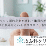 パックリ割れたあかぎれ・亀裂の治療｜ステロイド外用とハイドロコロイド材の活用