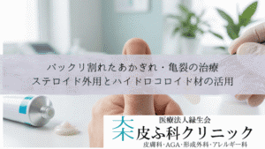 パックリ割れたあかぎれ・亀裂の治療｜ステロイド外用とハイドロコロイド材の活用