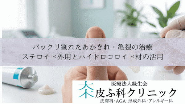 パックリ割れたあかぎれ・亀裂の治療｜ステロイド外用とハイドロコロイド材の活用