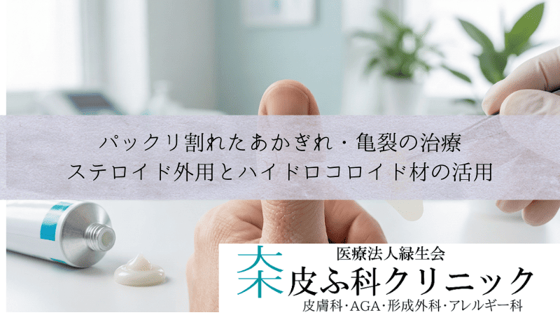 パックリ割れたあかぎれ・亀裂の治療｜ステロイド外用とハイドロコロイド材の活用